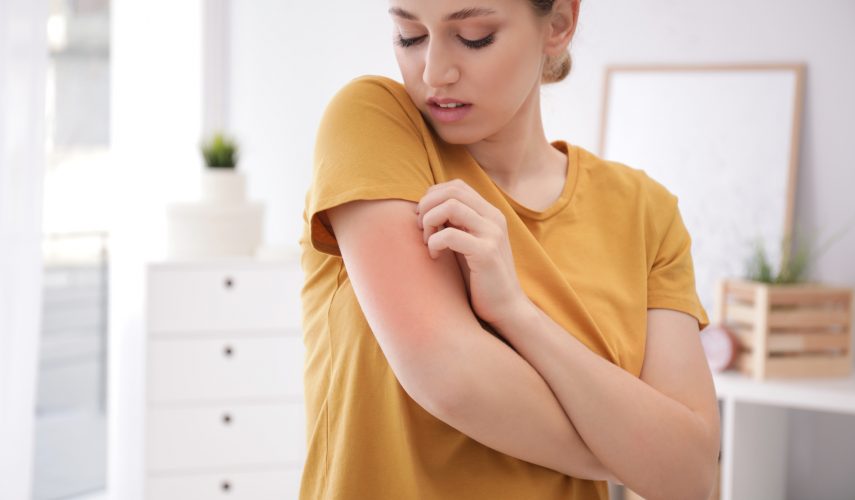 Woman scratching arm indoors, space for text. Allergy symptoms